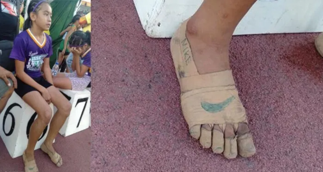 TIKTAK.ID - Tak Punya Sepatu, Bocah Ini Lomba Lari Degan Cara Kakinya Diperban, Hasilnya Sabet 3 Medali