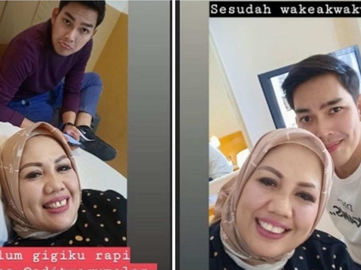 Elly Sugigi lakukan potong gigi makin cantik