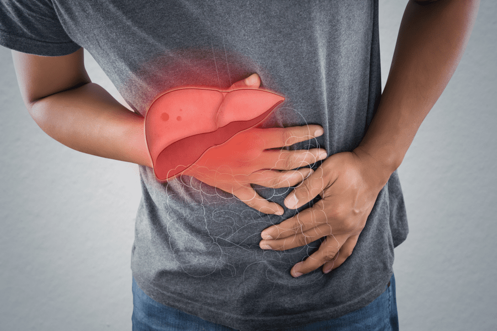 Lakukan 3 Cara ini Agar Tak Tertular Virus Hepatitis A