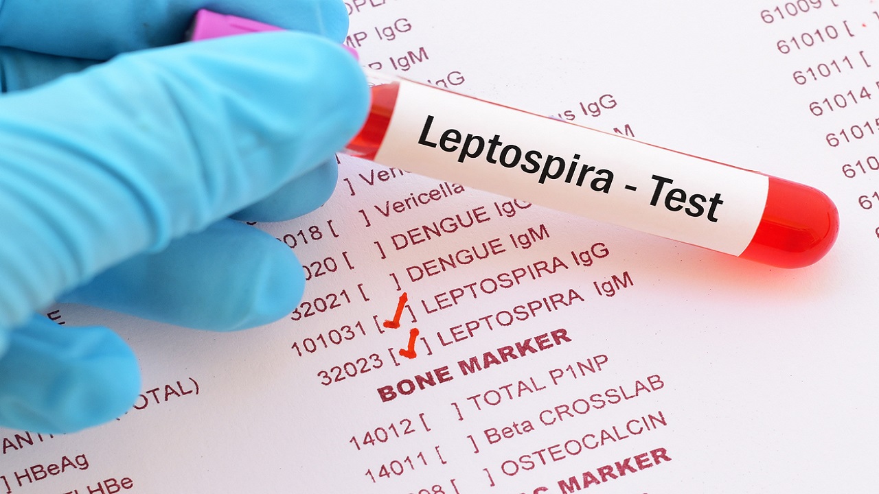 Langkah Mudah Kenal Leptospirosis Lewat Infografis