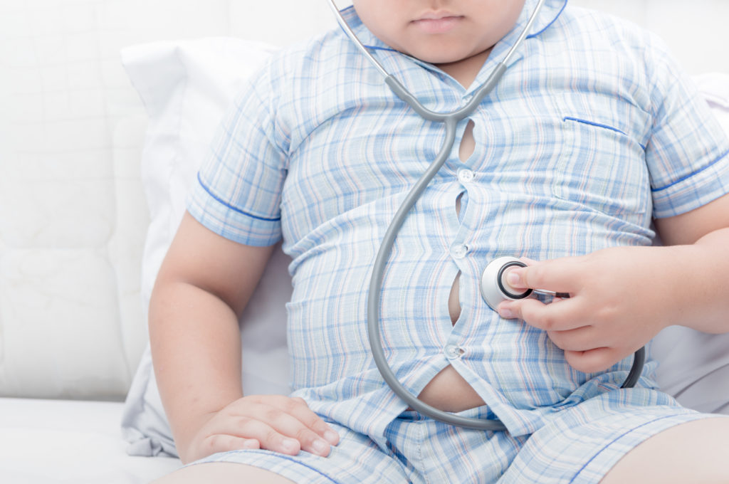 Obesitas Ternyata Bisa Lemahkan Daya Ingat Anak