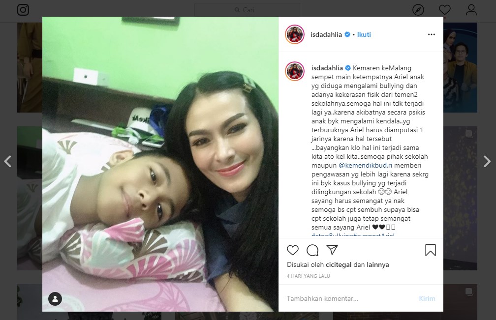 Beri Support Langsung, Iis Dahlia Sambangi Bocah Korban Perundungan di Malang