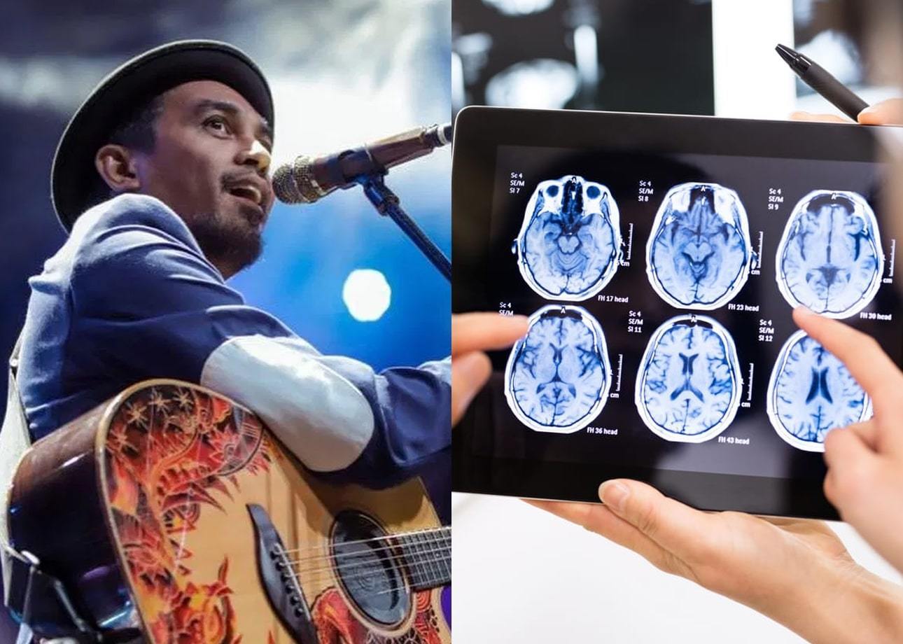 Asupan Tepat Pencegah Penyakit Meningitis seperti yang Diidap Glenn Fredly sebelum Meninggal