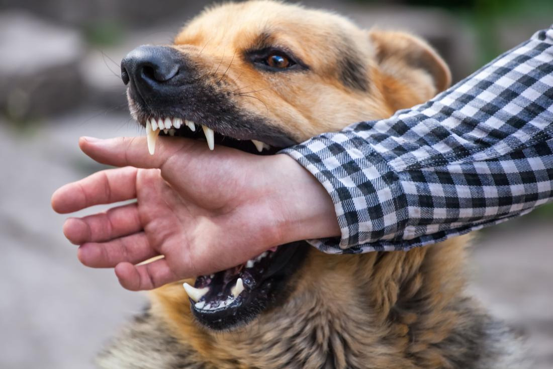 Ketahui Pertolongan Pertama Saat Digigit Anjing
